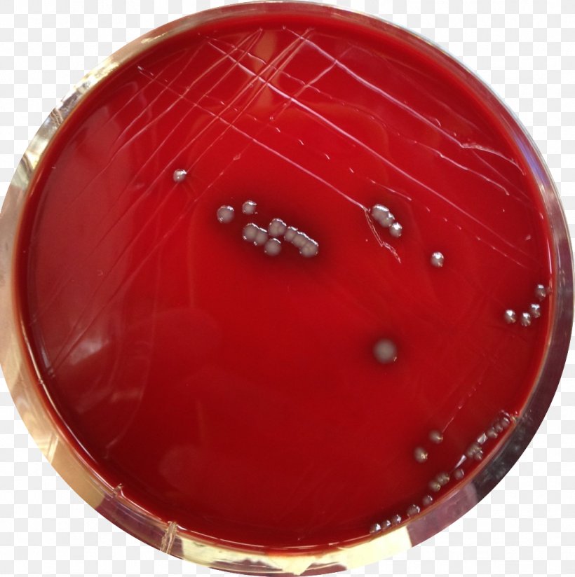 Staphylococcus Aureus Agar Sang Agar Plate Staphylococcus Epidermidis, PNG, 1067x1073px, Staphylococcus Aureus, Agar, Agar Plate, Agar Sang, Bacteria Download Free