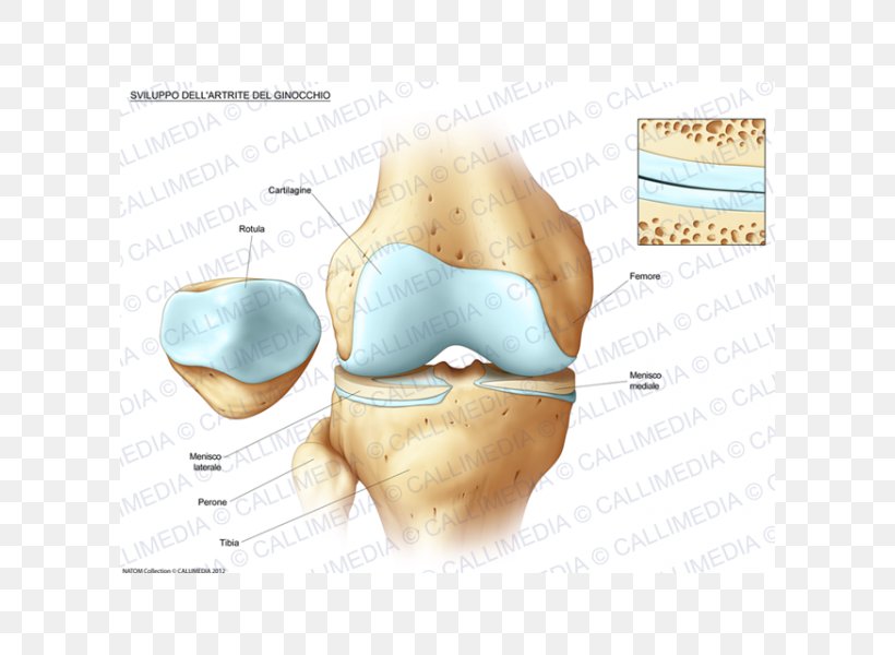 Knee Osteoarthritis Anatomy Bone Fracture, PNG, 600x600px, Watercolor, Cartoon, Flower, Frame, Heart Download Free