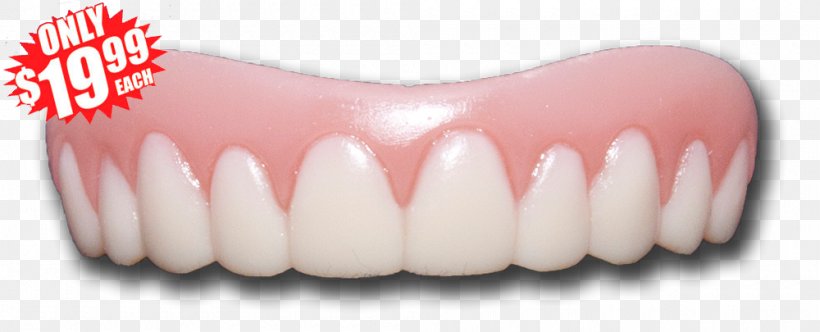 Human Tooth Smile Veneer Cosmetic Dentistry, PNG, 1000x405px, Tooth, Cosmetic Dentistry, Dentistry, Dentures, Eyelash Download Free