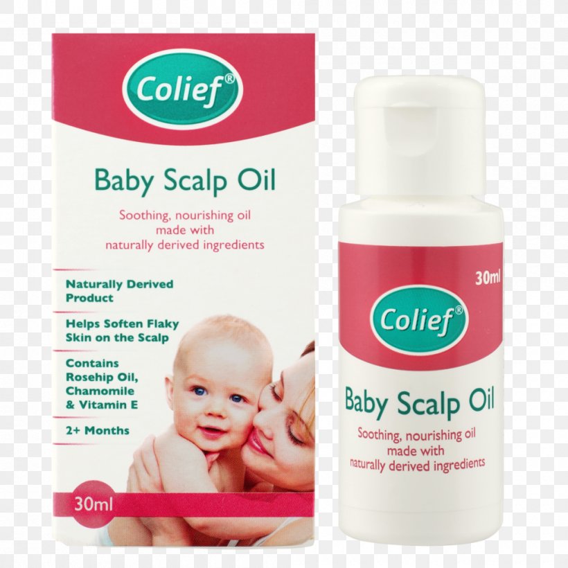 Scalp Cream Oil Infant Child, PNG, 1000x1000px, Scalp, Child, Cradle Cap, Cream, Drop Download Free