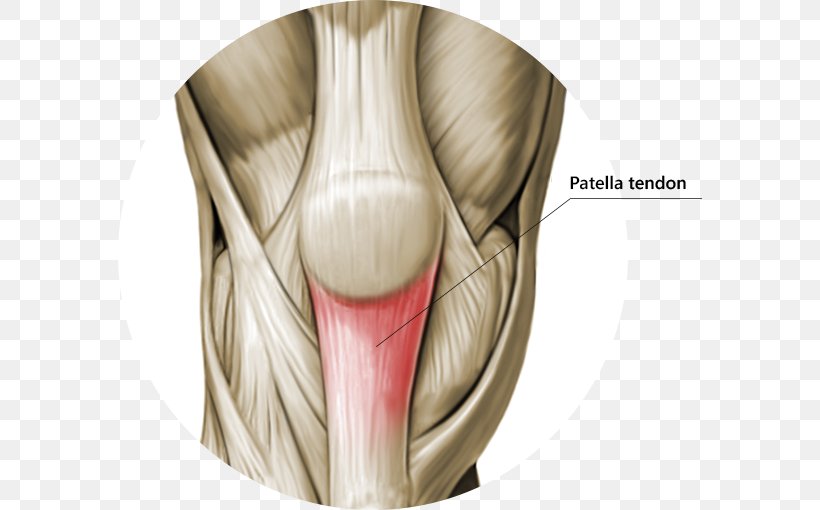 Knee Patellar Tendinitis Tendon Patellar Ligament, PNG, 584x510px, Knee, Ache, Anatomy, Femur, Human Body Download Free