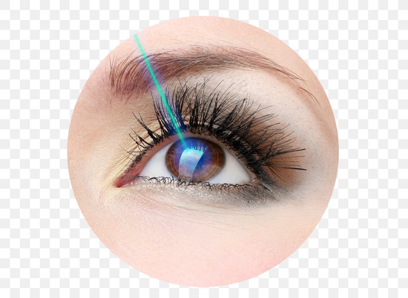 Refractive Surgery LASIK Ophthalmology Astigmatism, PNG, 600x600px, Refractive Surgery, Astigmatism, Close Up, Contact Lenses, Cornea Download Free