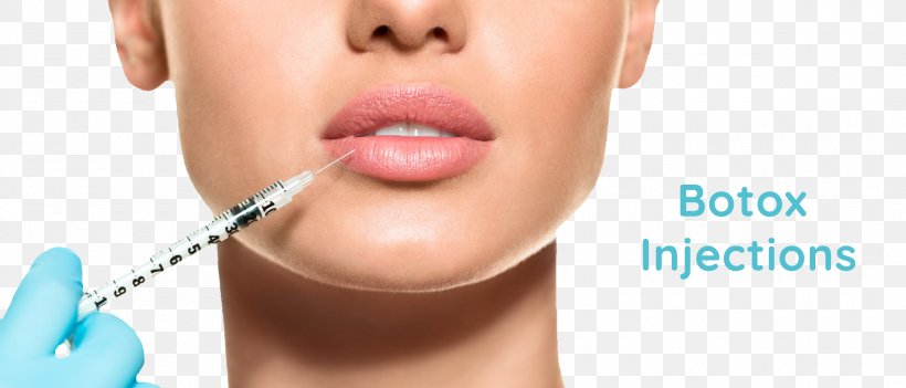 Lip Augmentation Injection Botulinum Toxin Injectable Filler Wrinkle, PNG, 2100x900px, Lip Augmentation, Aesthetic Medicine, Antiaging Cream, Beauty, Botulinum Toxin Download Free