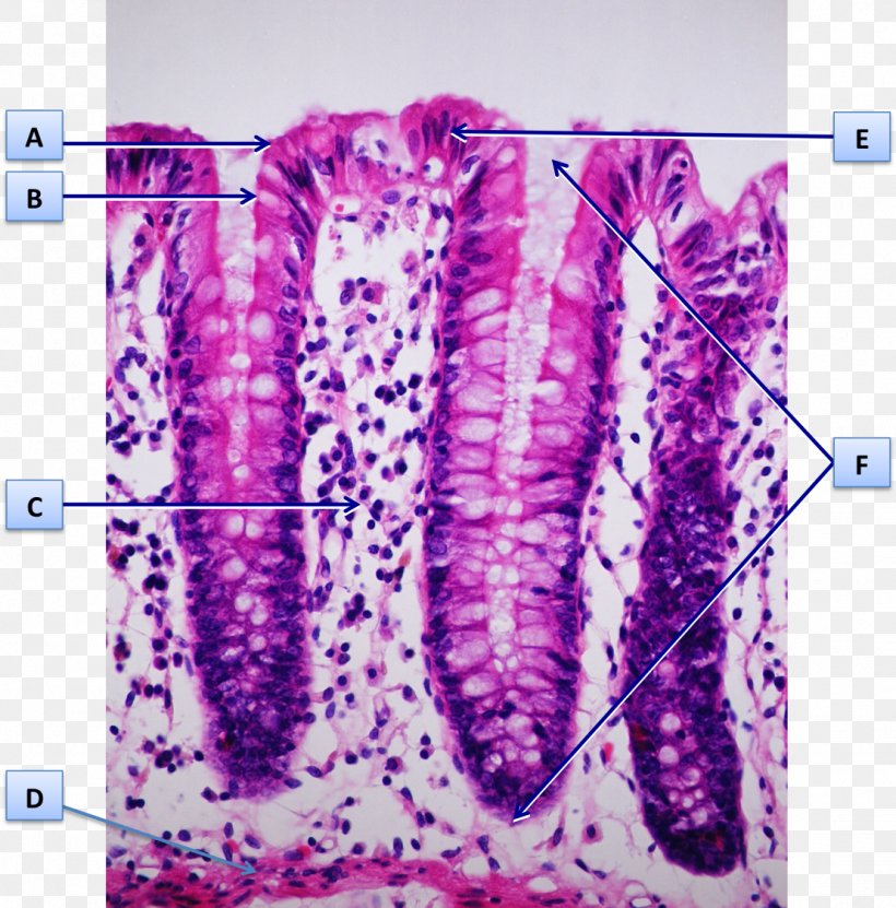 Mucous Membrane Intestinal Gland Goblet Cell Histology Colon, PNG, 1109x1125px, Mucous Membrane, Cell, Colon, Digestion, Dye Download Free