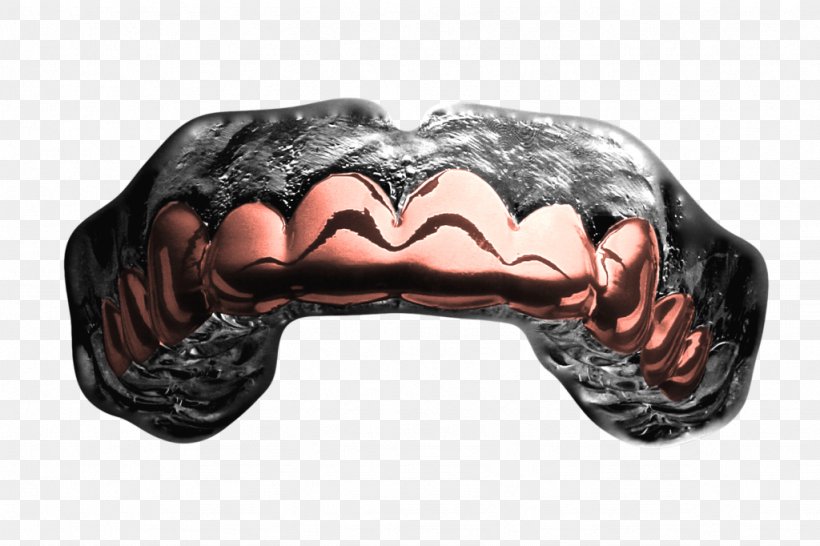 Mouthguard Grill Gold Jaw, PNG, 1024x682px, Mouthguard, American Football, Biting, Boxing, Dentist Download Free