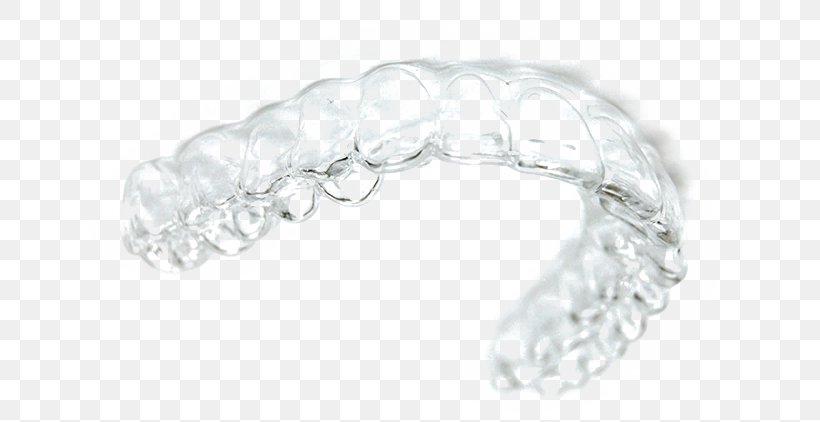 Orthodontics Clear Aligners Элайнер Dentistry Jaw, PNG, 651x422px, Orthodontics, Body Jewellery, Body Jewelry, Bone, Bracelet Download Free