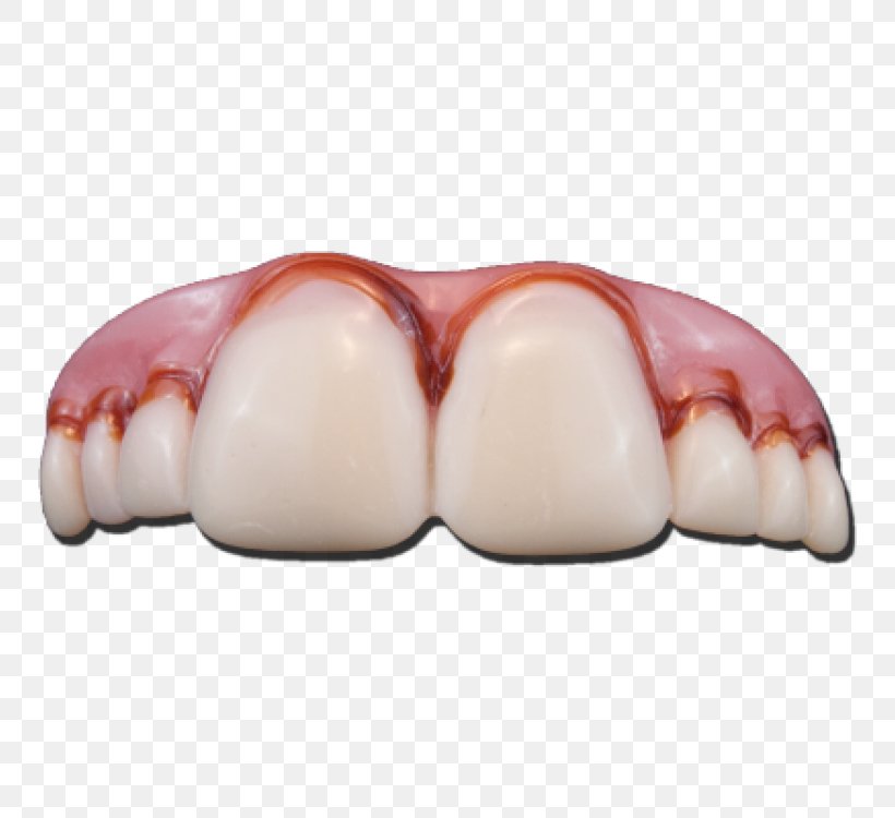 Human Tooth Dentures Fang Malocclusion, PNG, 750x750px, Tooth, Clothing, Costume, Dental Braces, Dentistry Download Free