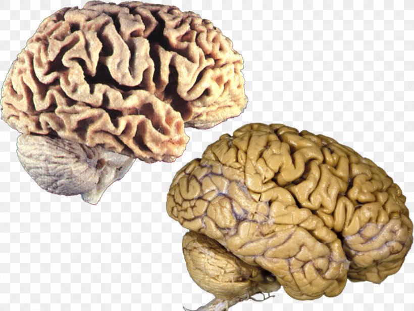 Human Brain Brain Size Anatomy, PNG, 1500x1125px, Watercolor, Cartoon, Flower, Frame, Heart Download Free