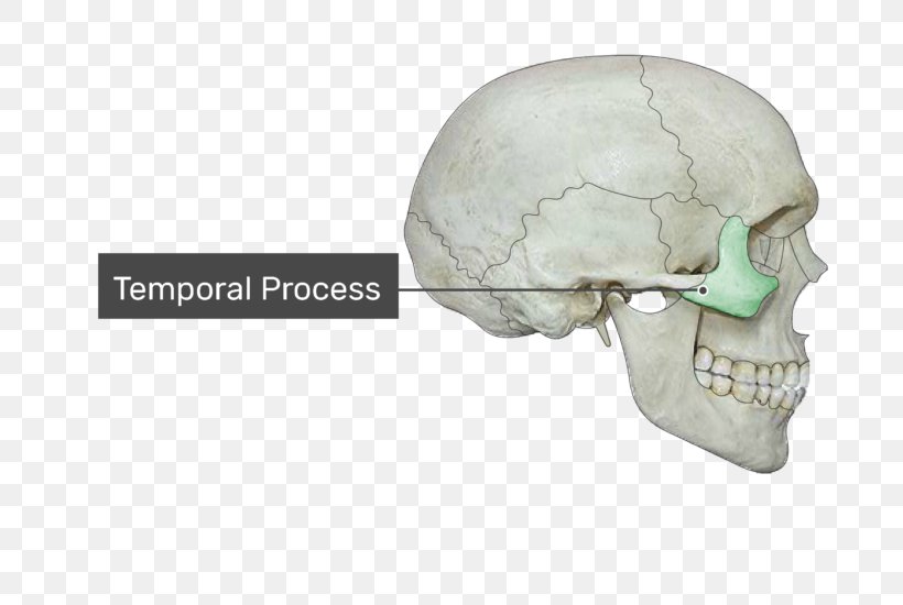 Condyloid Process Coronoid Process Of The Mandible Zygomatic Process Of Temporal Bone, PNG, 770x550px, Condyloid Process, Alveolar Process, Bone, Coronoid Process Of The Ulna, Frontal Process Of Maxilla Download Free