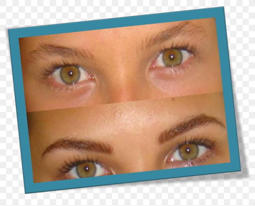 Consultorios Dermatològicos Dra. Squaglia Eyebrow Permanent Makeup Make-up, PNG, 811x662px, Eyebrow, Ache, Aesthetic Medicine, Beauty, Cheek Download Free