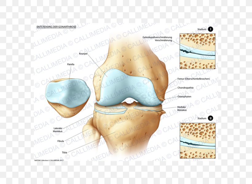Tibia Knee Pain Bone Fracture Joint, PNG, 600x600px, Tibia, Bone, Bone Fracture, Disease, Ear Download Free