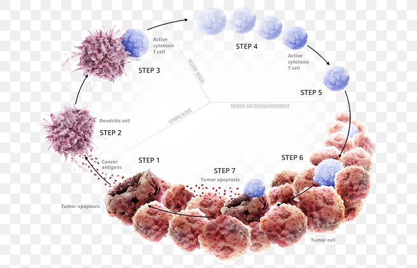 Cancer Immunotherapy Cancer Immunotherapy Immune System PD-L1, PNG, 679x526px, Cancer, Bead, Breast Cancer, Cancer Cell, Cancer Immunology Download Free