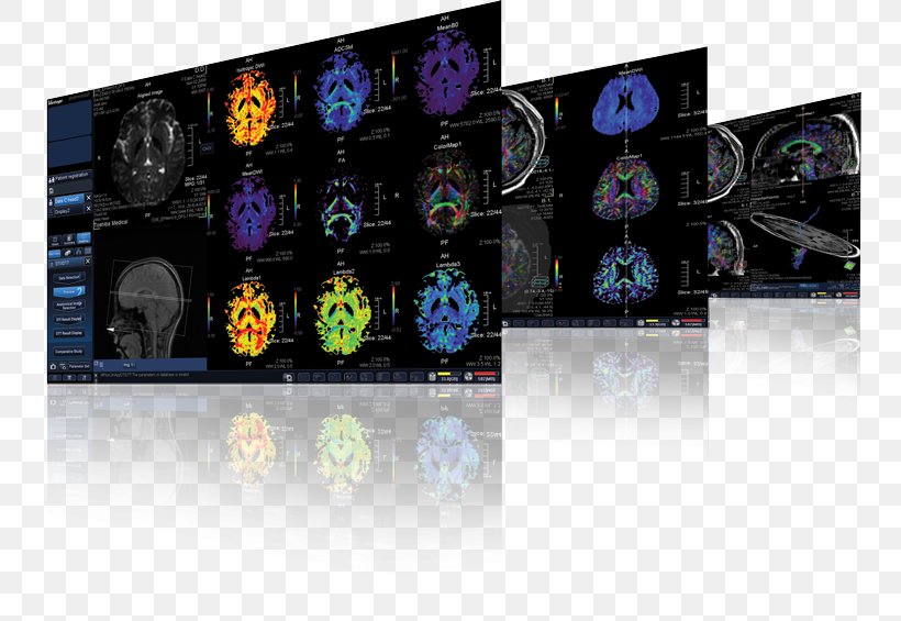 Magnetic Resonance Imaging Toshiba Canon Medical Systems Corporation MRI-scanner, PNG, 800x565px, Magnetic Resonance Imaging, Brand, Canon, Canon Medical Systems Corporation, Contrast Download Free
