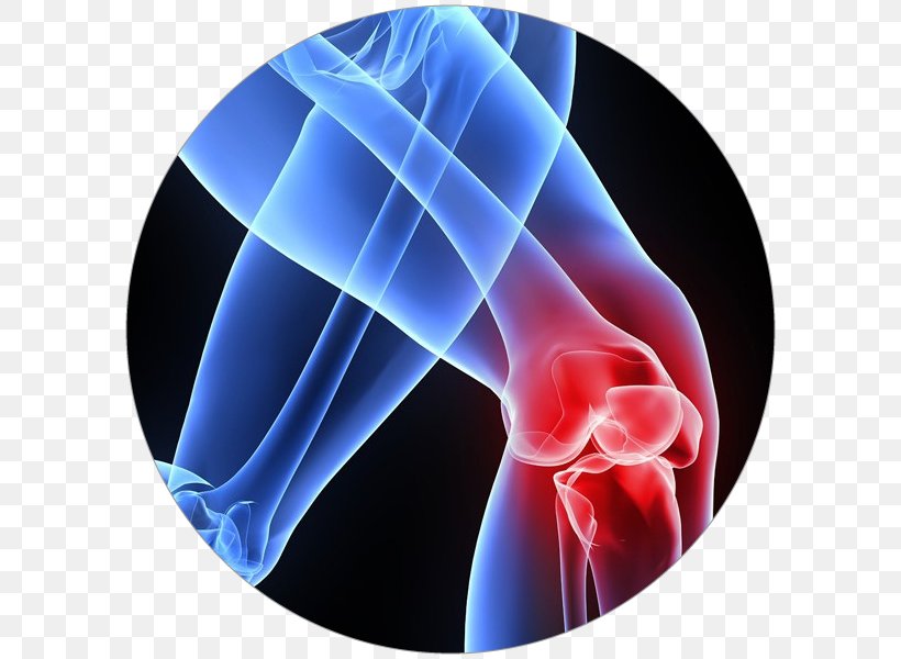 Patellar Tendinitis Tendinopathy Knee Pain, PNG, 600x600px, Tendinitis, Electric Blue, Inflammation, Injury, Joint Download Free