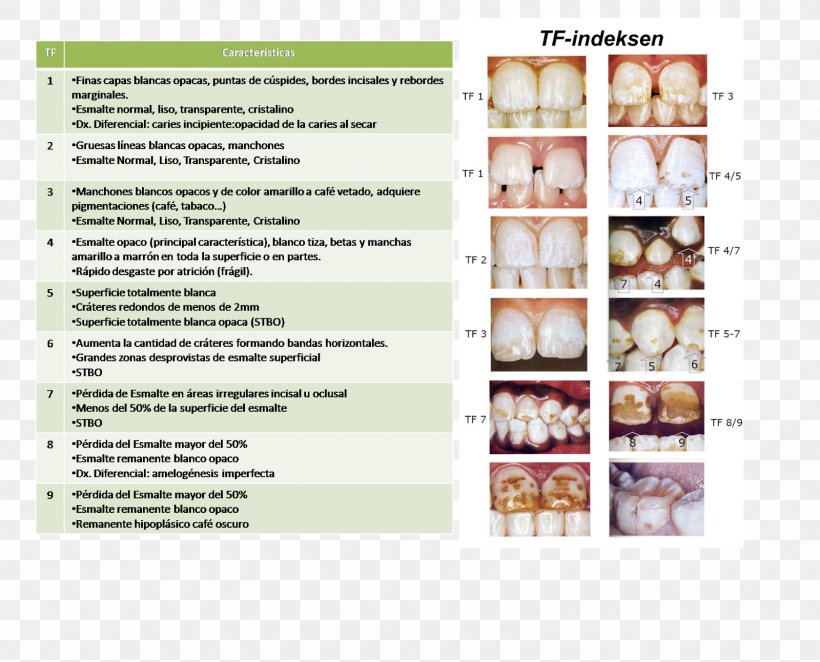 Advertising Dental Fluorosis Dentistry Brochure, PNG, 1600x1292px, Advertising, Brochure, Dental Fluorosis, Dentistry, Media Download Free