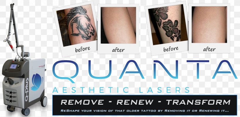 Flashpoint Tattoo Company Tattoo Removal Laser Cover-up, PNG, 1052x515px, 2017, Tattoo Removal, Advertising, Brand, British Columbia Download Free