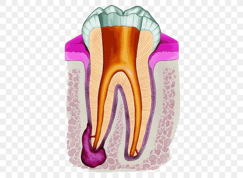 Endodontic Therapy Root Canal Endodontics Dentistry, PNG, 435x600px, Watercolor, Cartoon, Flower, Frame, Heart Download Free
