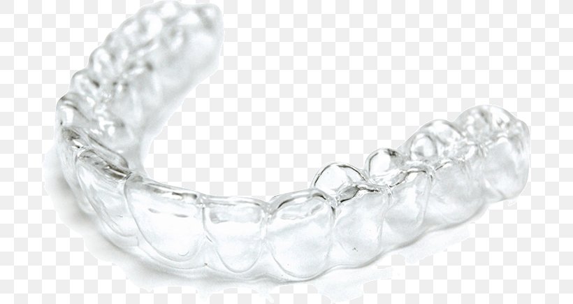 Clear Aligners Dental Braces Dentistry Interceptive Orthodontics, PNG, 700x435px, Clear Aligners, Bangle, Body Jewelry, Bracelet, Cosmetic Dentistry Download Free