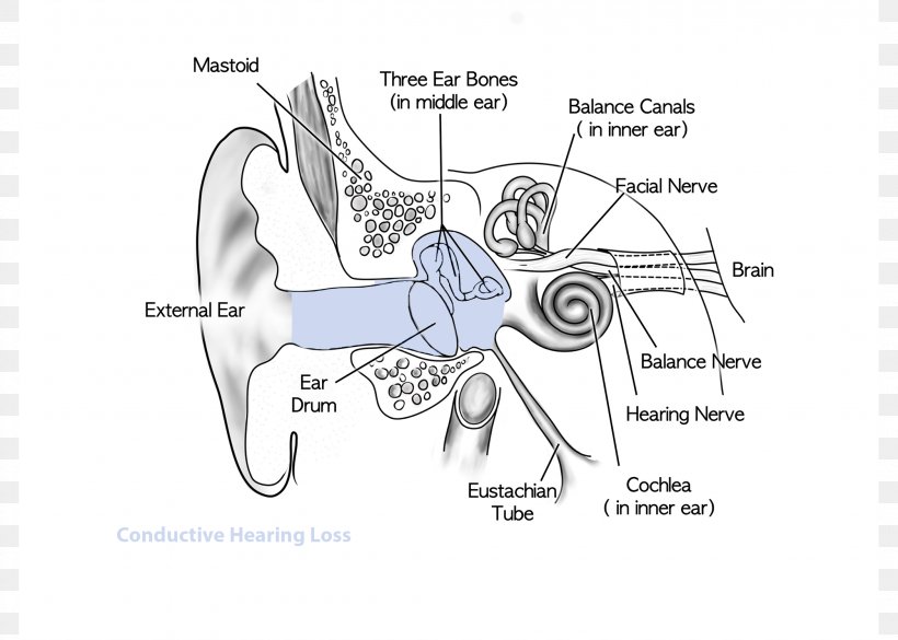 Sensorineural Hearing Loss Conductive Hearing Loss, PNG, 2100x1500px, Watercolor, Cartoon, Flower, Frame, Heart Download Free