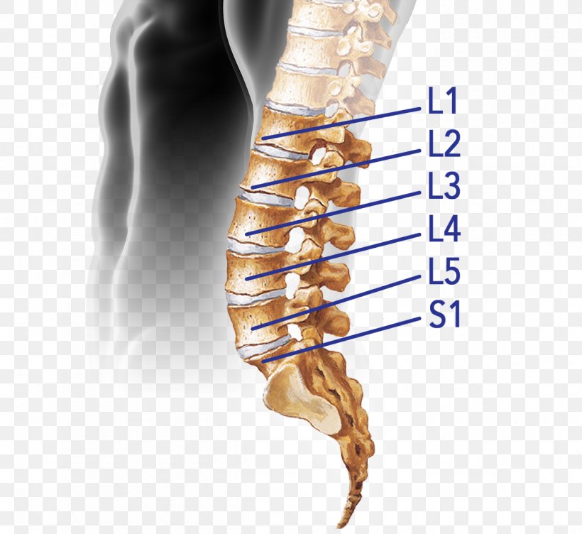 Vertebral Column Spinal Disc Herniation Intervertebral Disc Lumbar Vertebrae Spinal Cord, PNG, 1200x1101px, Vertebral Column, Arm, Back Pain, Finger, Hand Download Free
