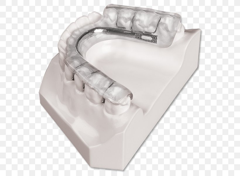 Splint Dentistry Temporomandibular Joint Dysfunction Therapy Orthopedic Surgery, PNG, 594x600px, Splint, Dentistry, Face, Home Appliance, Mandible Download Free