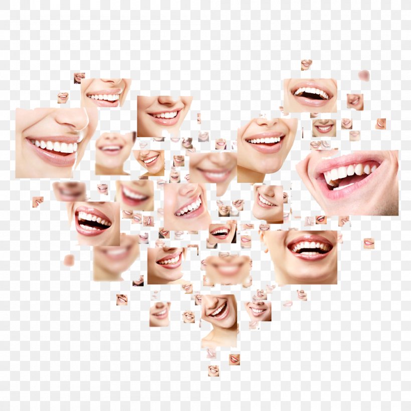 Smile Stock Photography Dentistry Human Tooth Shutterstock, PNG, 1000x1000px, Stock Photography, Cheek, Collage, Cosmetic Dentistry, Dentist Download Free