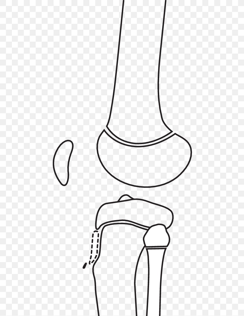 Book Drawing, PNG, 481x1061px, Human Leg, Art, Blackandwhite, Bone Fracture, Coloring Book Download Free