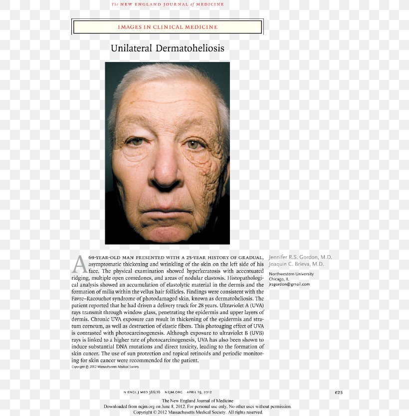 Photoaging Ultraviolet Skin Care Truck Driver, PNG, 572x833px, Photoaging, Ageing, Chin, Eyebrow, Face Download Free