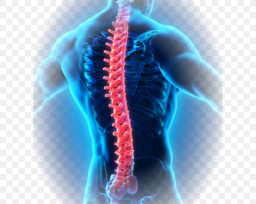 Surgery Medicine Therapy Disease Ankylosing Spondylitis, PNG, 607x656px, Surgery, Anatomy, Ankylosing Spondylitis, Arthritis, Back Pain Download Free