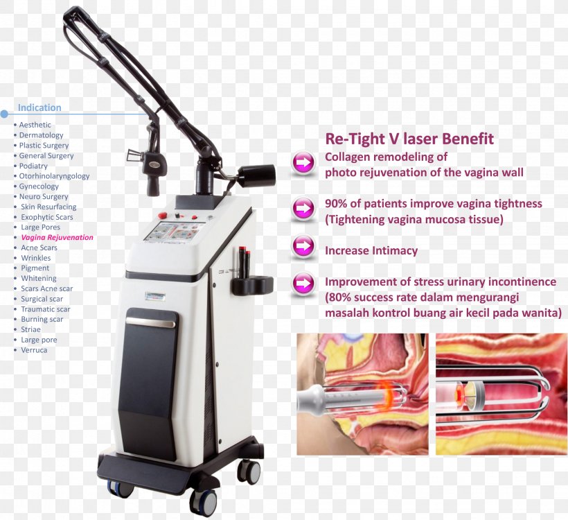 Carbon Dioxide Laser Nd:YAG Laser Laser Hair Removal, PNG, 2044x1870px, Watercolor, Cartoon, Flower, Frame, Heart Download Free