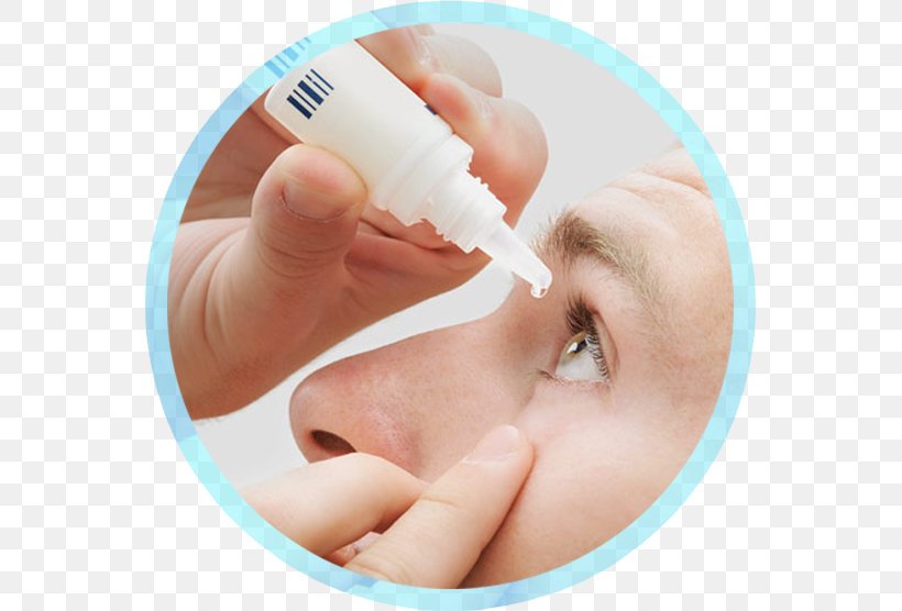Dry Eye Syndrome Optometry Glaucoma Ophthalmology, PNG, 555x556px, Dry Eye Syndrome, Cheek, Chin, Close Up, Conjunctivitis Download Free