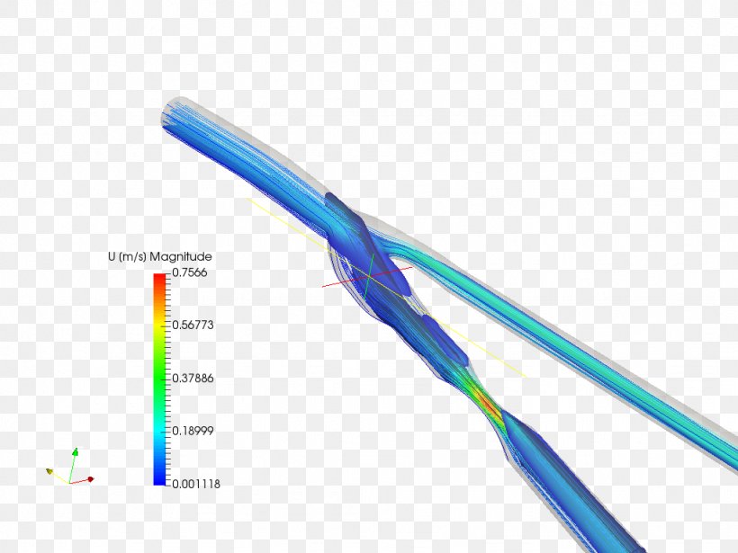 Common Carotid Artery Blood Vessel Hemodynamics, PNG, 1024x768px, Artery, Blood, Blood Vessel, Common Carotid Artery, Electronics Download Free