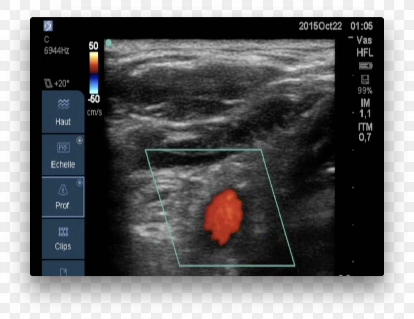 Medical Imaging Magnetic Resonance Imaging Screenshot Medicine, PNG, 1534x1184px, Medical Imaging, Joint, Magnetic Resonance Imaging, Medical, Medicine Download Free