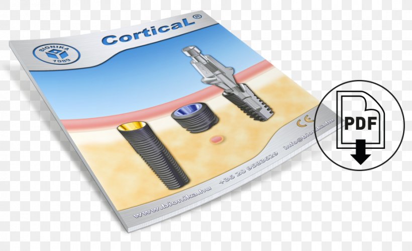 Cortical Implant Bionics System PDF, PNG, 928x565px, Implant, Average, Bionics, Bone, Brand Download Free