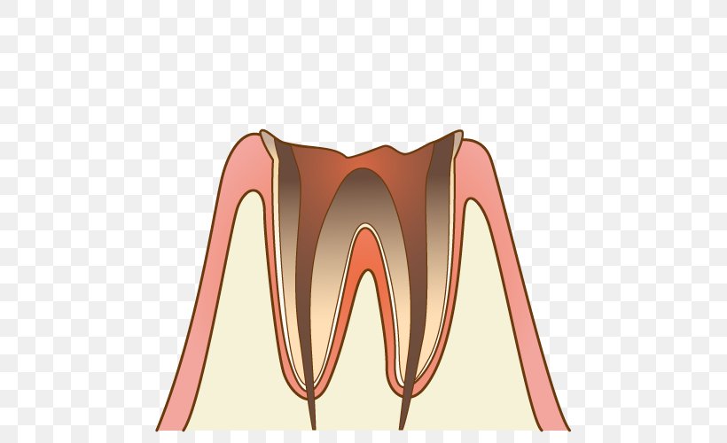歯科 Dentist Periodontal Disease Tooth Decay, PNG, 500x500px, Watercolor, Cartoon, Flower, Frame, Heart Download Free
