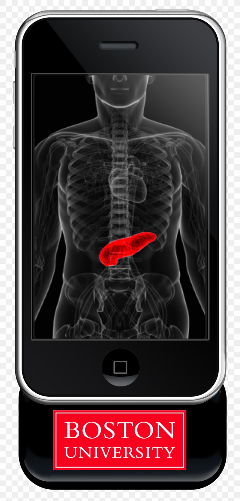 Diabetes Mellitus Kidney Failure Pancreas Insulin, PNG, 880x1836px, Diabetes Mellitus, Blood Sugar, Disease, Electronics, Health Download Free