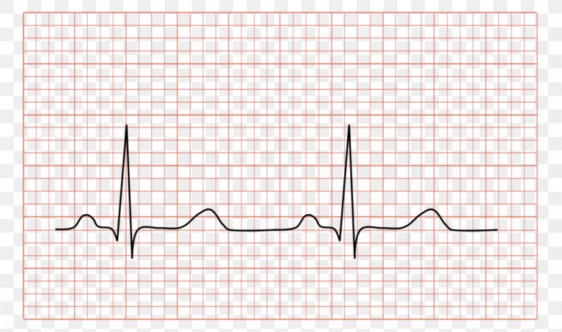 Electrocardiography Electrocardiogram Cardiology Heart Medicine, PNG, 1024x606px, Watercolor, Cartoon, Flower, Frame, Heart Download Free