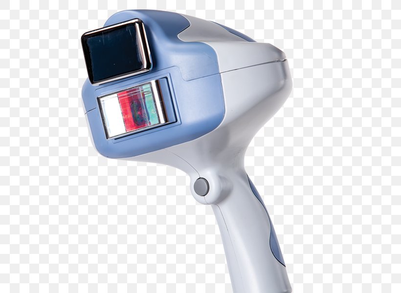 Intense Pulsed Light Fotoepilazione Hair Removal, PNG, 800x600px, Light, Beauty, Cosmetics, Fotoepilazione, Hair Download Free