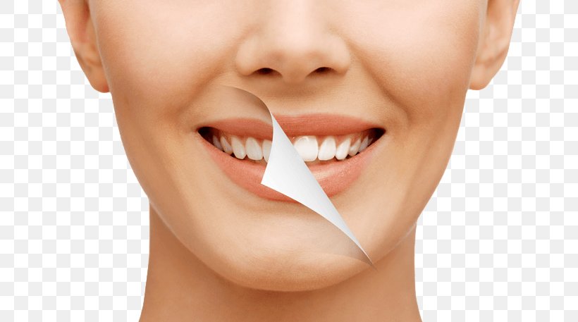 Freedom Dental Cosmetic Dentistry Makeover, PNG, 800x457px, Dentist, Cheek, Chin, Close Up, Cosmetic Dentistry Download Free
