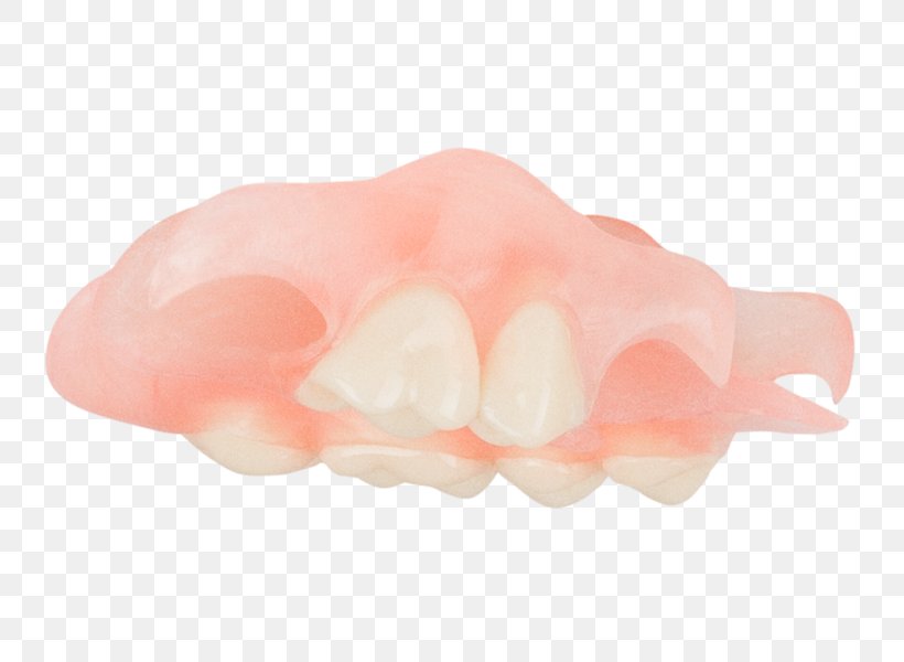 Dentures Jaw Peach, PNG, 749x600px, Dentures, Jaw, Peach, Petal Download Free