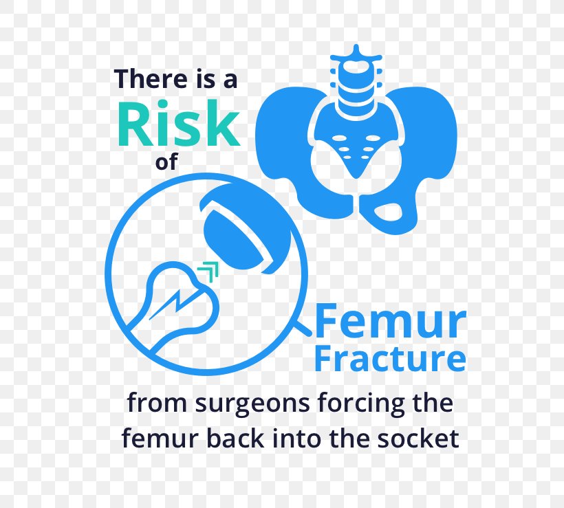 Femur Hip Fracture Femoral Head Bone Fracture Femoral Fracture, PNG, 554x739px, Femur, Acetabulum, Area, Blue, Bone Fracture Download Free