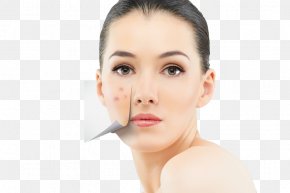 Skin - Skin Care Health Acne Diet PNG