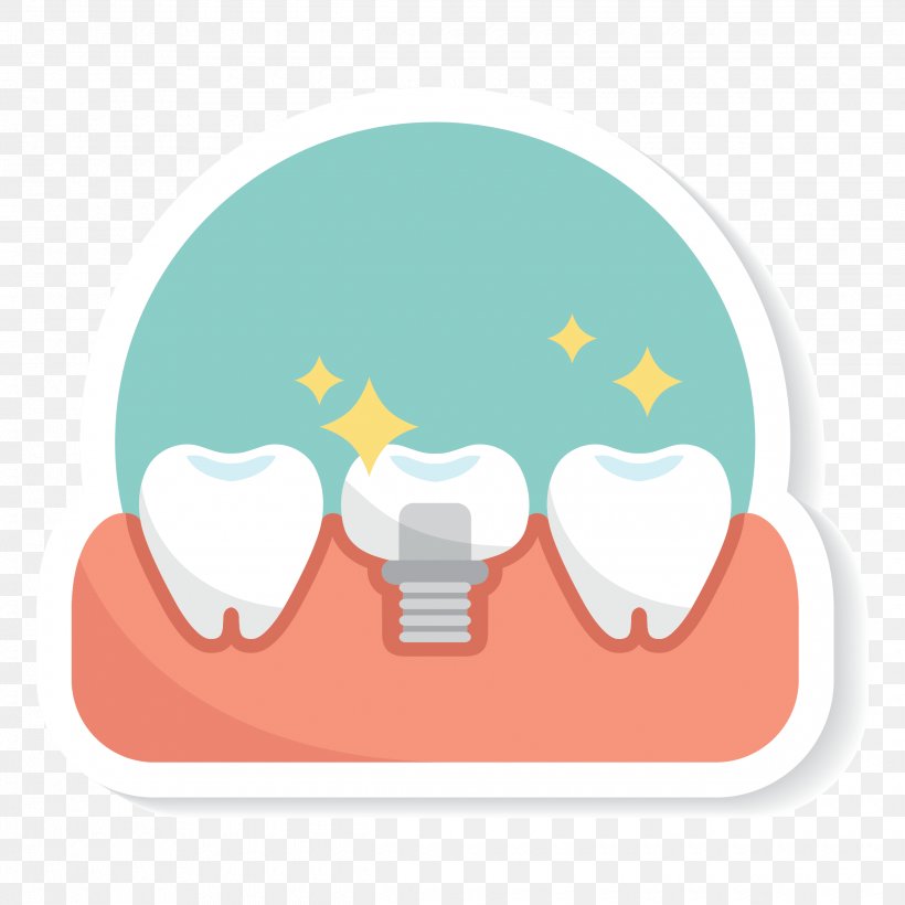 Dental Implant Edentulism Dental Extraction Dentistry Clip Art, PNG, 2480x2480px, Dental Implant, Cosmetic Dentistry, Dental Extraction, Dental Floss, Dental Instruments Download Free