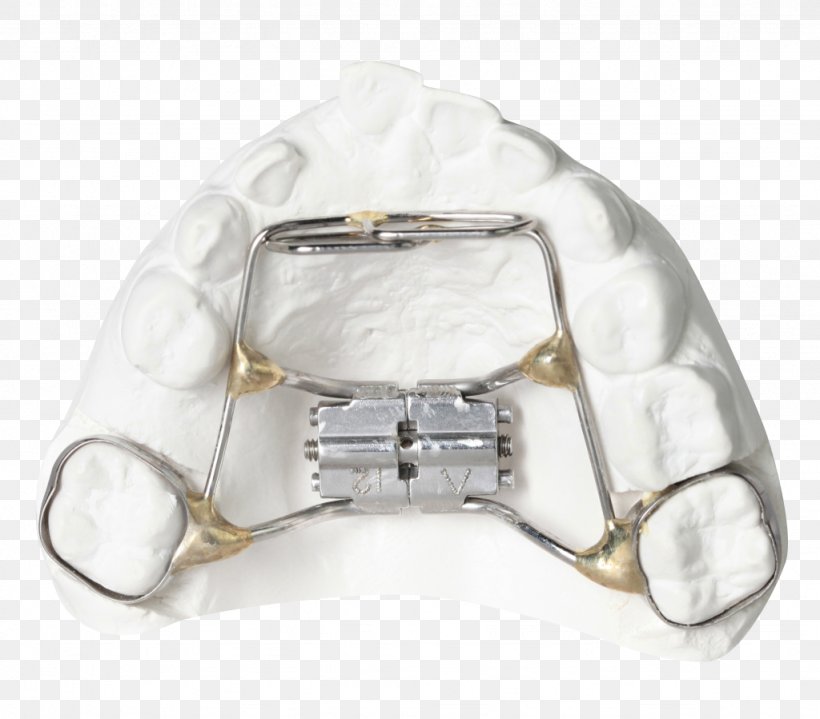Orthodontics Tooth Clear Aligners Retainer Dental Braces, PNG, 1024x899px, Orthodontics, Apnea, Bionator, Clear Aligners, Cots Download Free