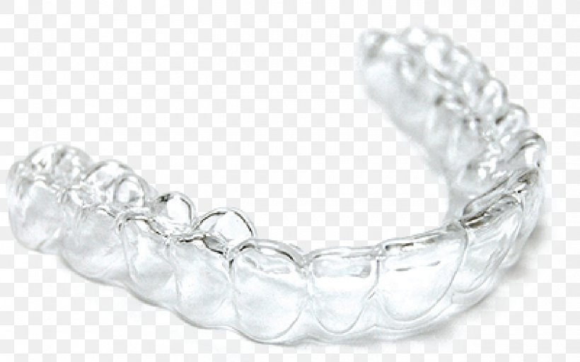 Clear Aligners Dentistry Orthodontics Dental Braces Tooth, PNG, 1400x875px, Clear Aligners, Bangle, Body Jewelry, Bracelet, Dental Braces Download Free