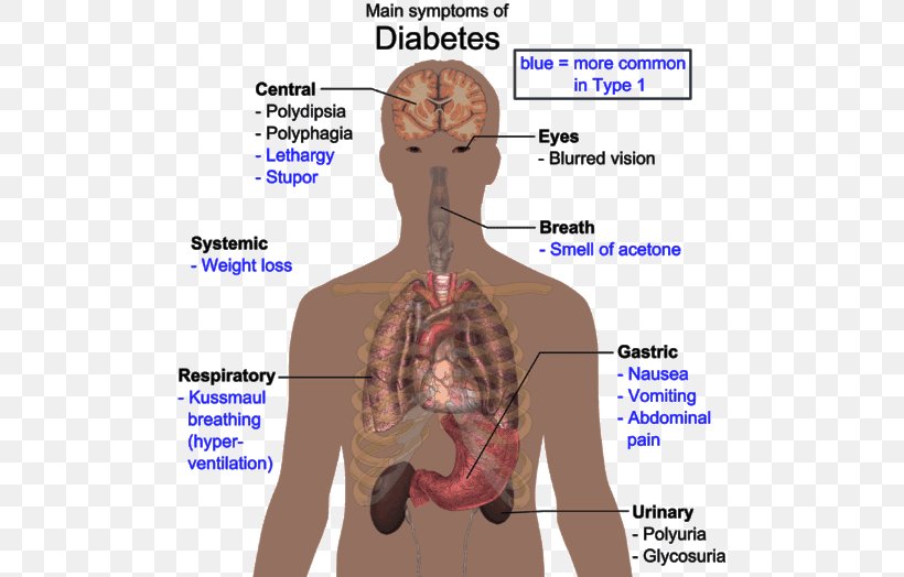 Diabetes Mellitus Type 2 Disease Human Body Type 1 Diabetes, PNG, 512x524px, Watercolor, Cartoon, Flower, Frame, Heart Download Free