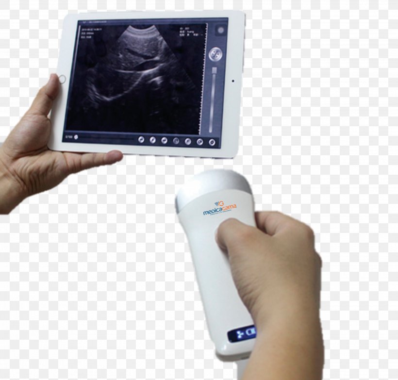 Mobile Phones Ultrasonography Ultrasound Medicine Doppler Echocardiography, PNG, 3100x2963px, Mobile Phones, Cause, Disease, Doppler Echocardiography, Doppler Ultrasonography Download Free