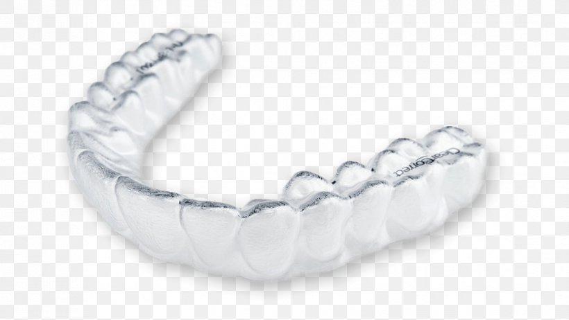 Clear Aligners ClearCorrect Dentistry Orthodontics Dental Braces, PNG, 1656x934px, Clear Aligners, Align Technology, Body Jewelry, Bracelet, Cadcam Dentistry Download Free