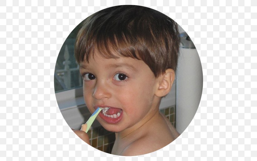 Cheek Tooth Decay Child Fluorine, PNG, 500x513px, Cheek, Age, Boy, Brown Hair, Chemical Element Download Free