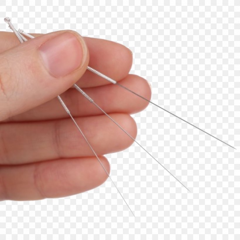 Dry Needling Physical Therapy Acupuncture Myofascial Trigger Point, PNG, 1967x1967px, Dry Needling, Acupuncture, Finger, Hand, Indication Download Free